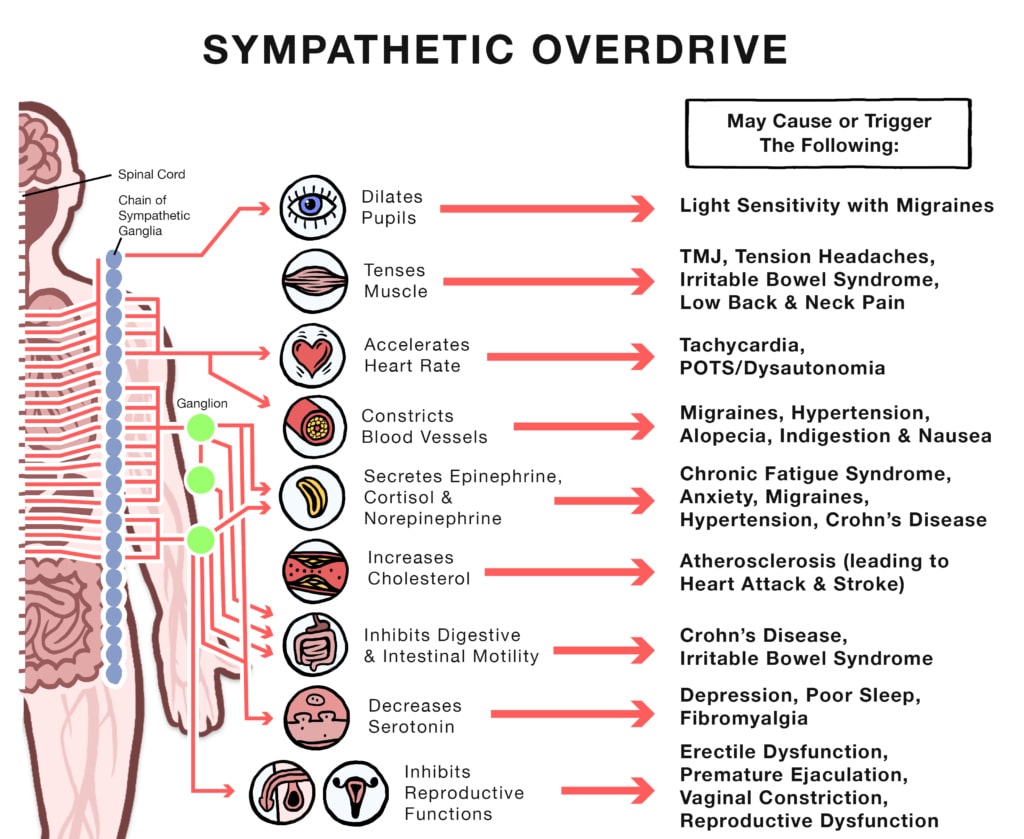 Sympathetic Overdrive Sympathetic Overdrive
