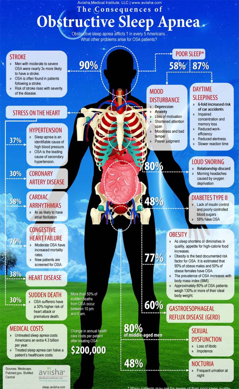 Consequences of Sleep Apnea Consequences of Sleep Apnea in Northern California